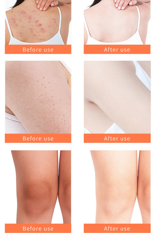 Turmeric Body Scrub | Golden Glow 150g
